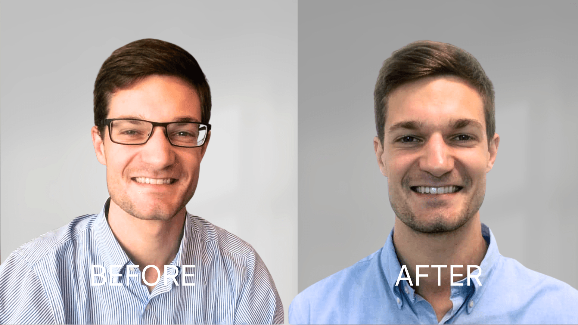 LASIK Eye Surgery