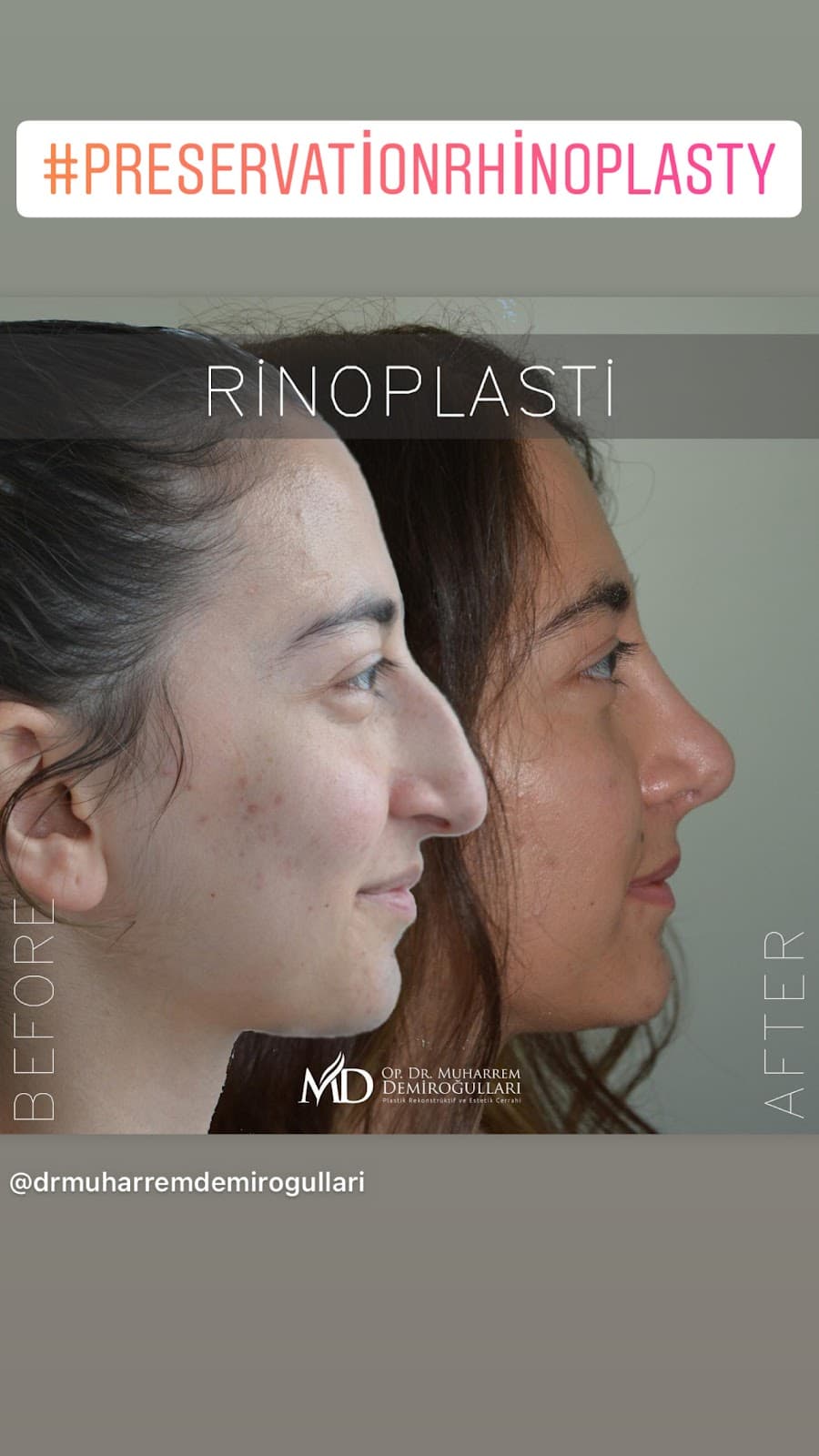 Muharremdemirogullari