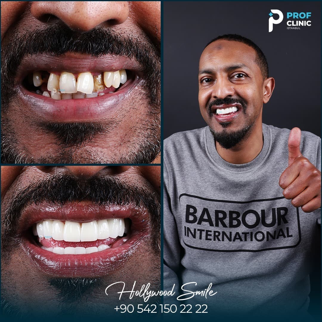 Prof Clinic | Dental Clinic Turkey