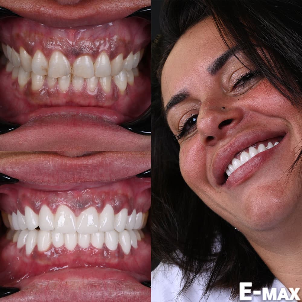 Best Dentist Istanbul | Dental | Hair Transplant | Hospital