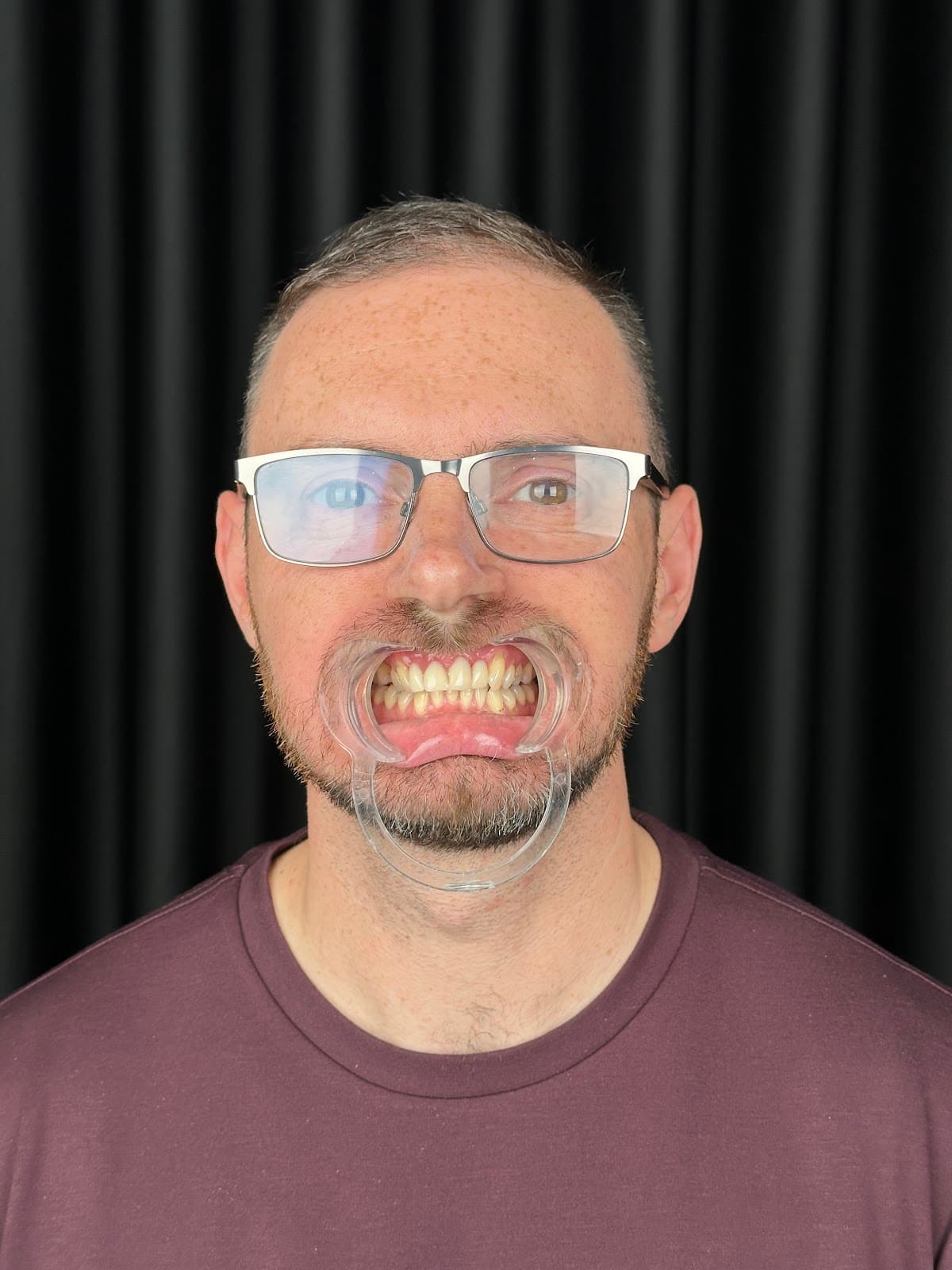 Best Dentist Istanbul | Dental | Hair Transplant | Hospital