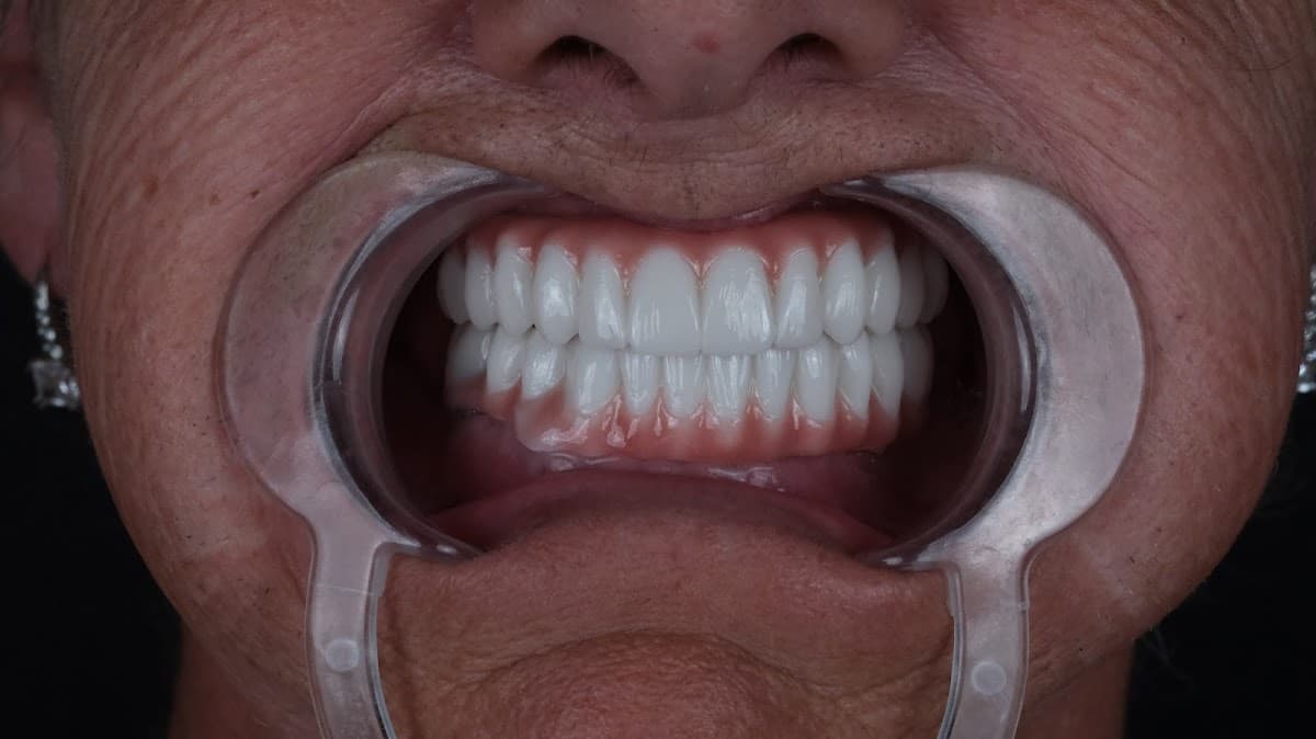 Oris Dental Turkey(Dental Center in Antalya)