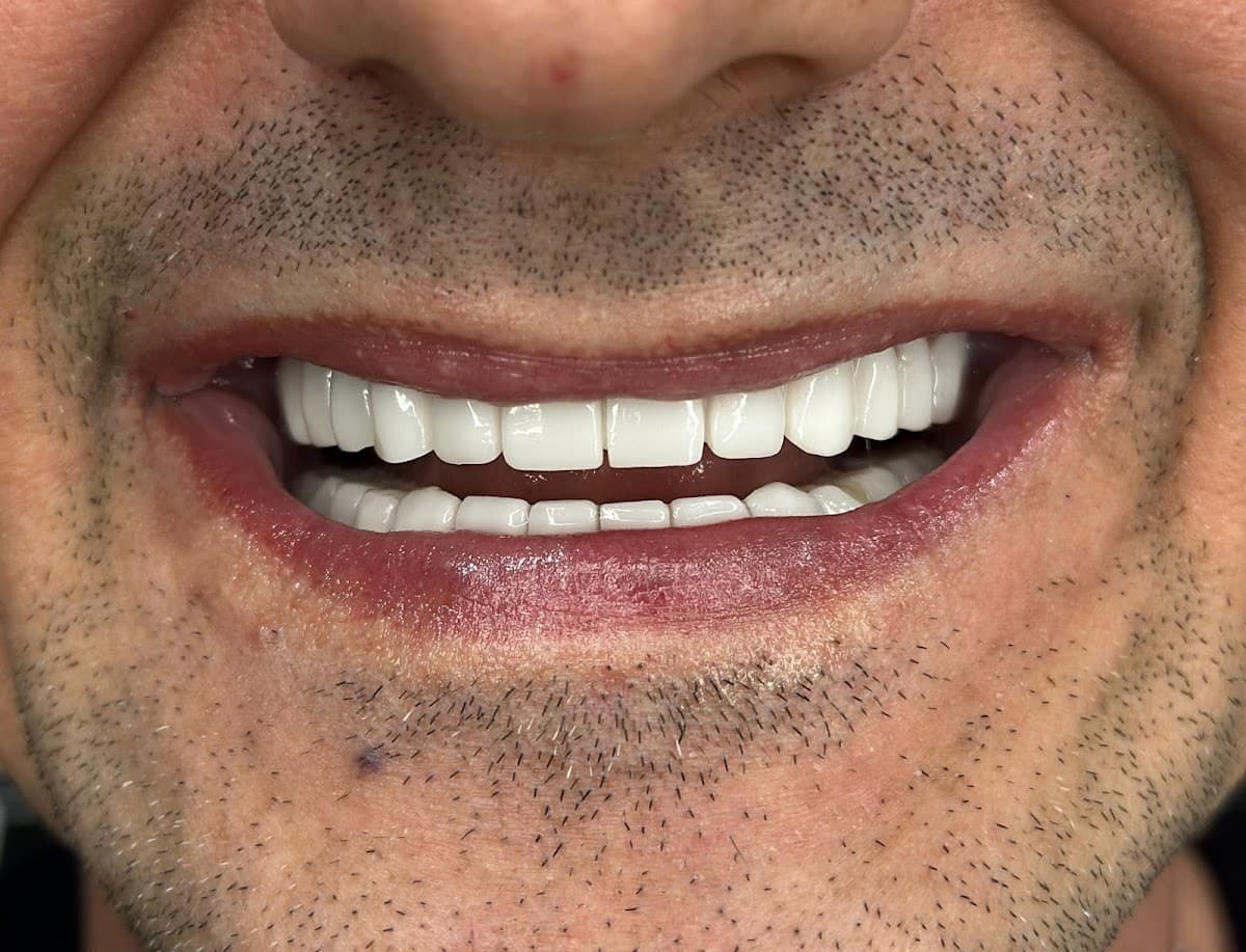 Venedik Dental Clinic Turkey – Dental Implants & Veneers