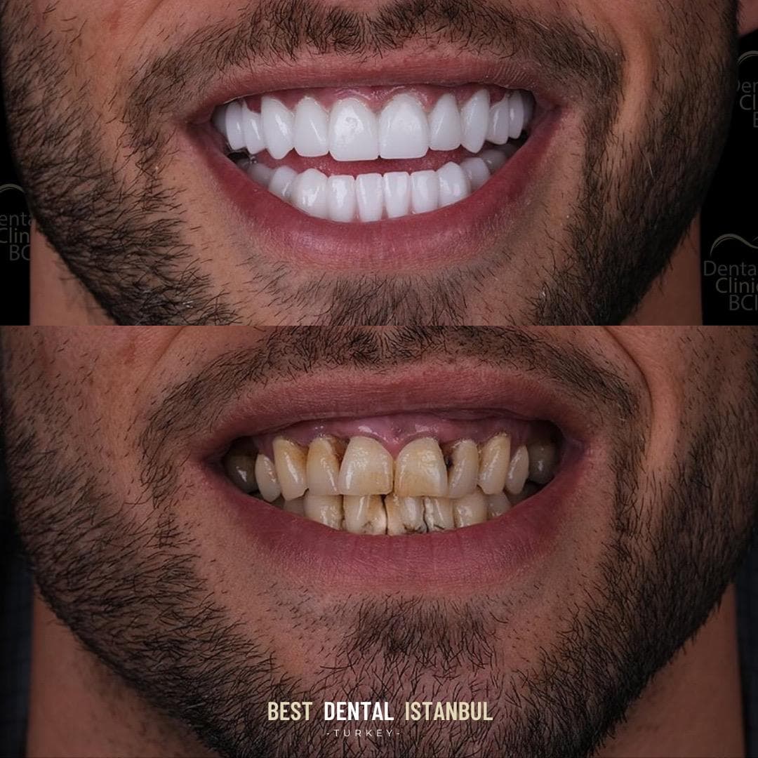 Best Dental Istanbul