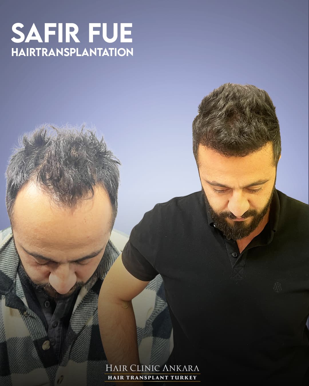 Hair Clinic Ankara