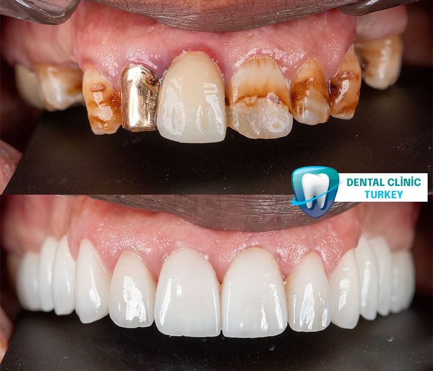Dental Clinics Turkey