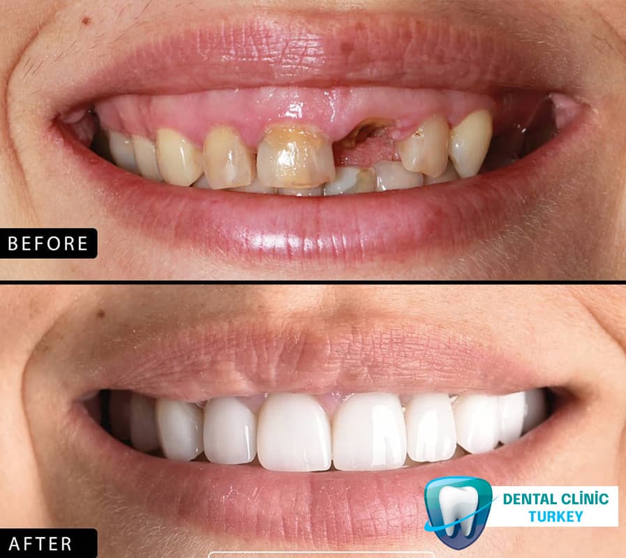 Dental Clinics Turkey