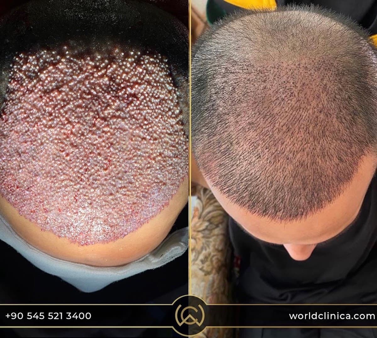World Clinica Hair Transplant & Cosmetic Surgeries
