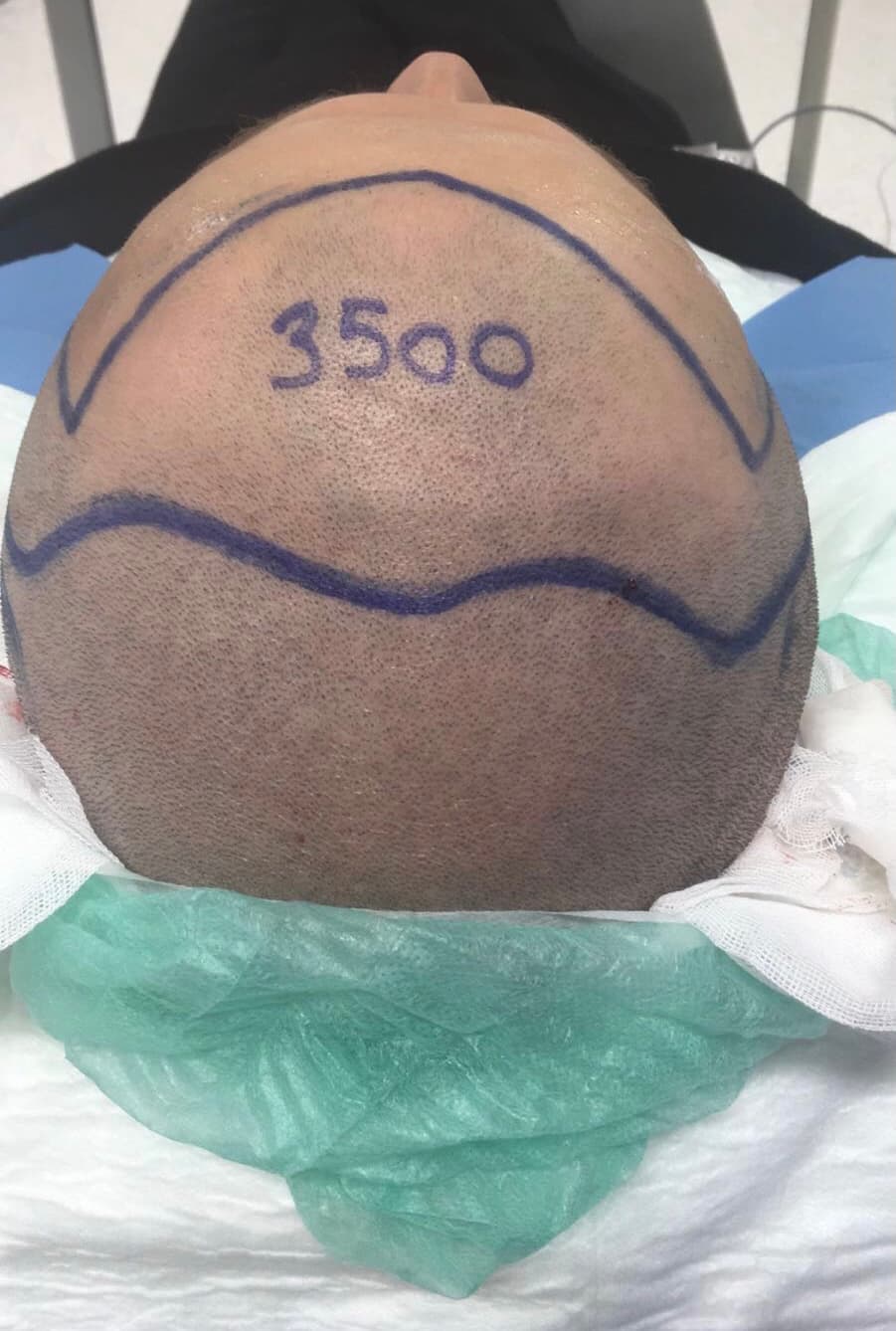 World Clinica Hair Transplant & Cosmetic Surgeries