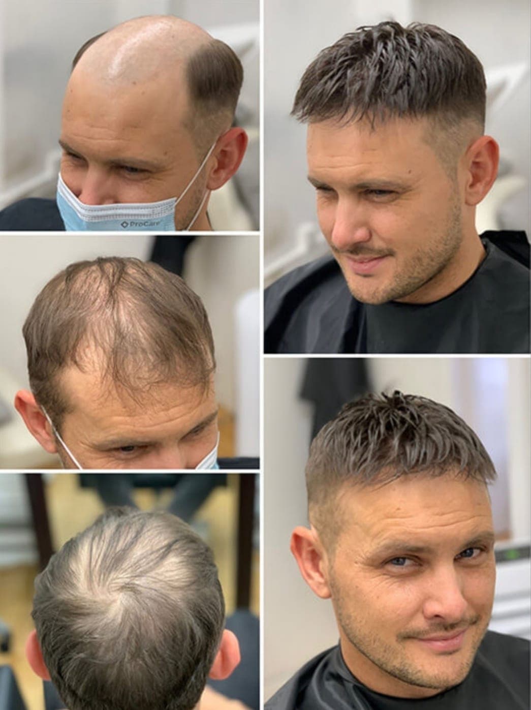 VOONHAİR PROTEZ SAÇ ANKARA