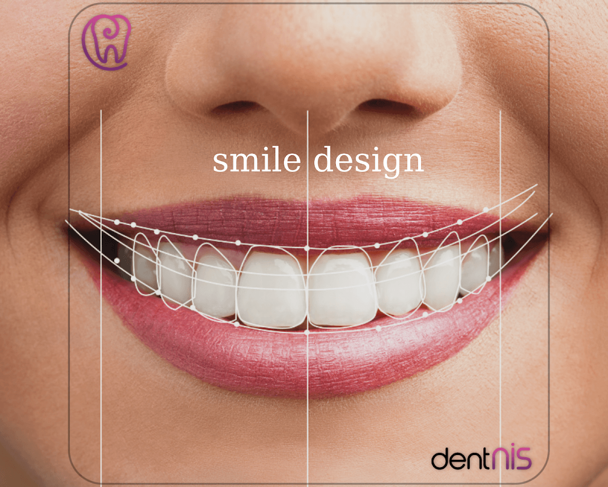 Dent Nis İmplantoloji ve Estetik Diş Kliniği Nişantaşı (Dr.Abdulkadir Narin)