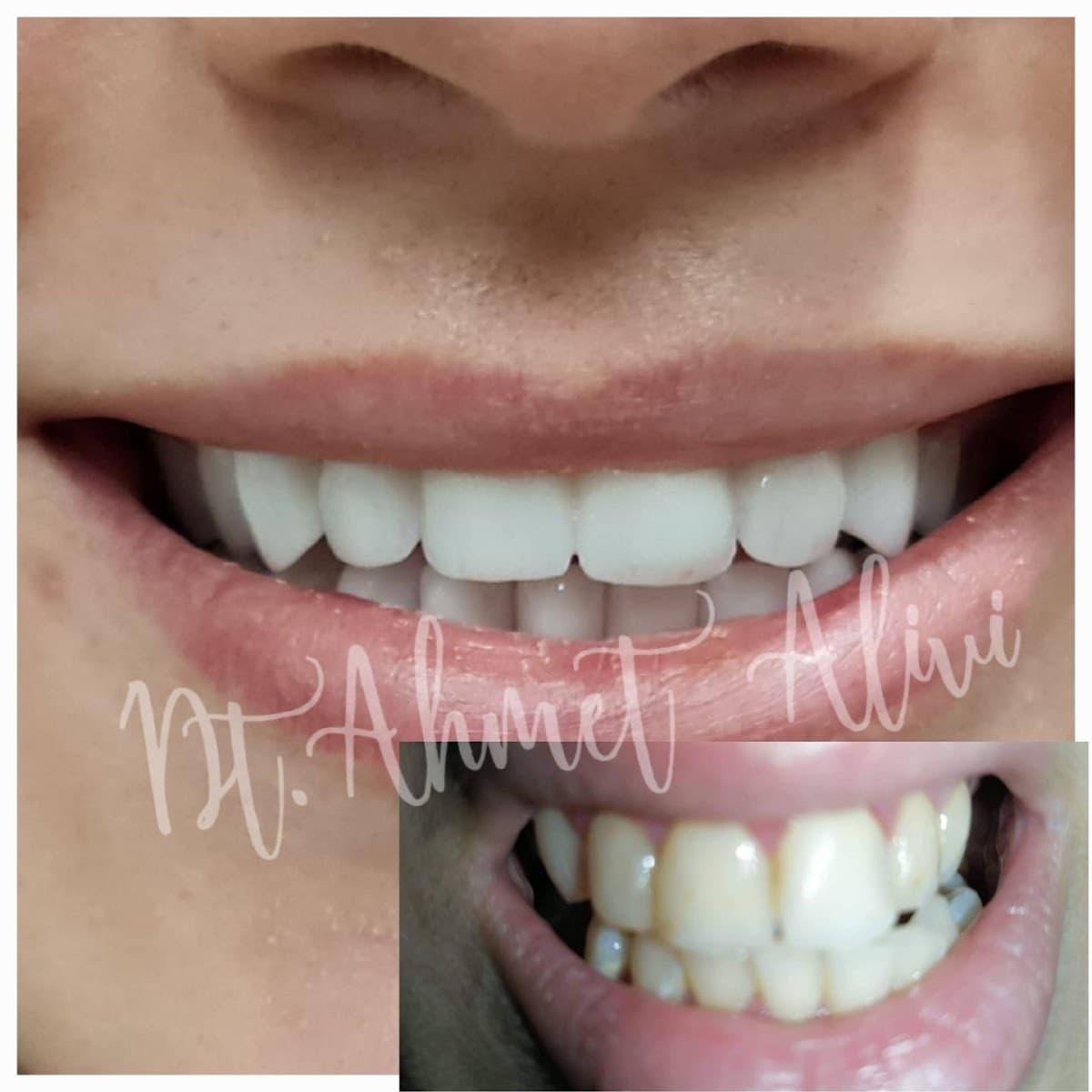 Dentist AHMET ALİVİ/Dental Clinic/طبيب أسنان عربي