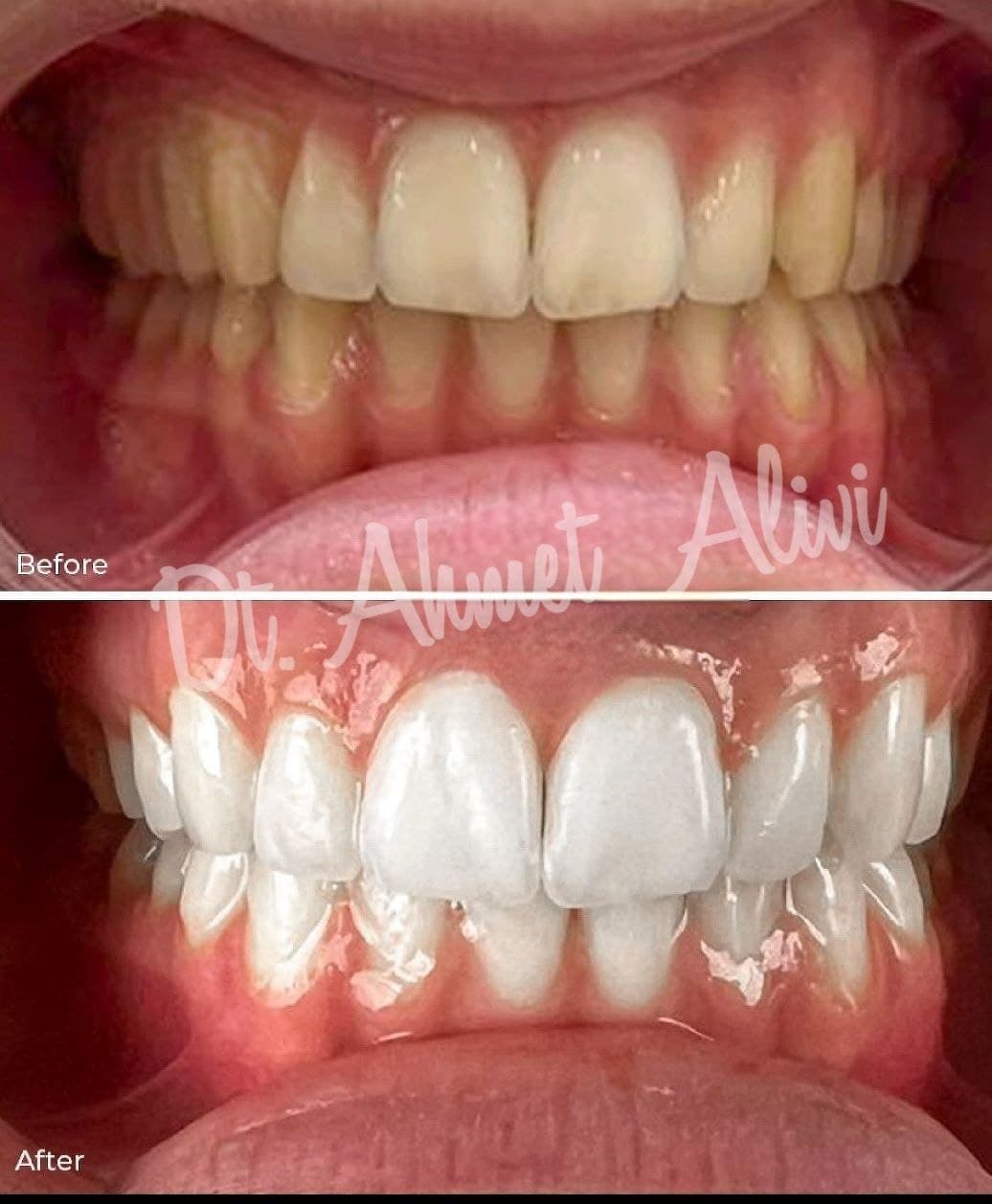 Dentist AHMET ALİVİ/Dental Clinic/طبيب أسنان عربي