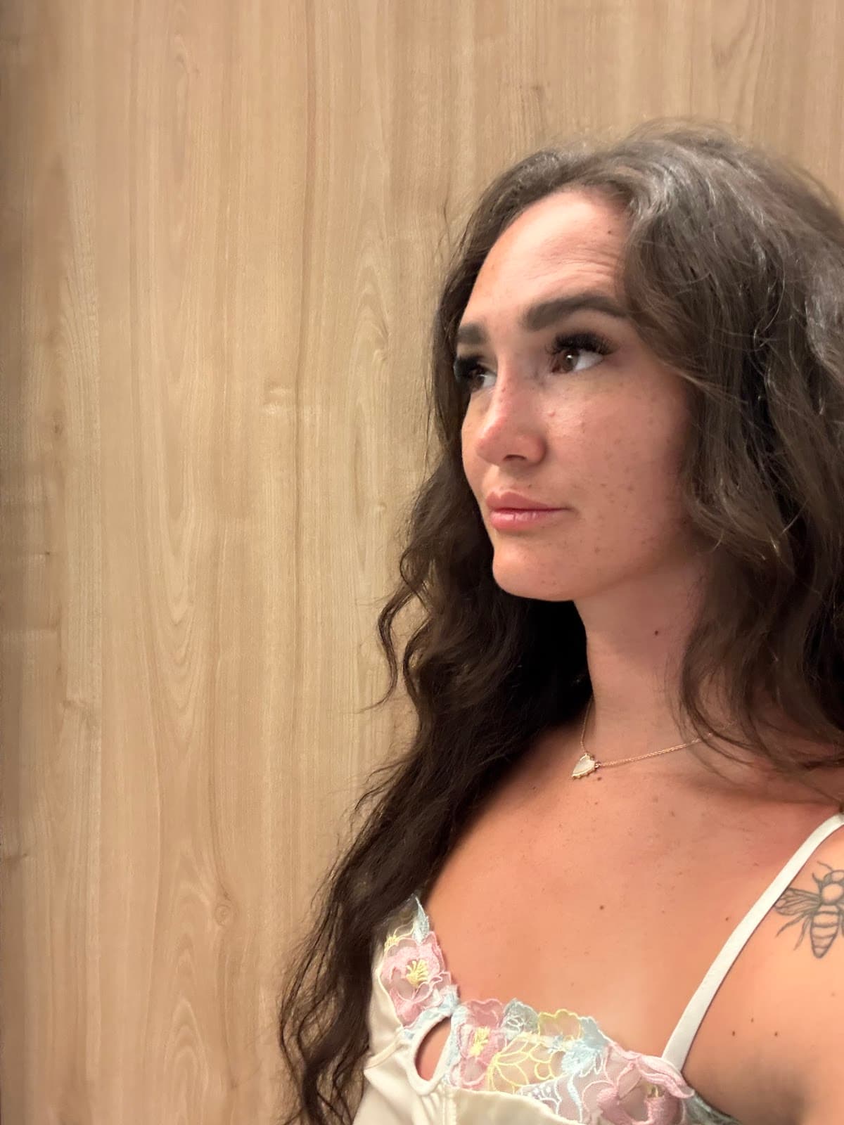 Doç. Dr. Burak Erdur - Burun Estetiği, Rinoplasti, Rhinoplasty