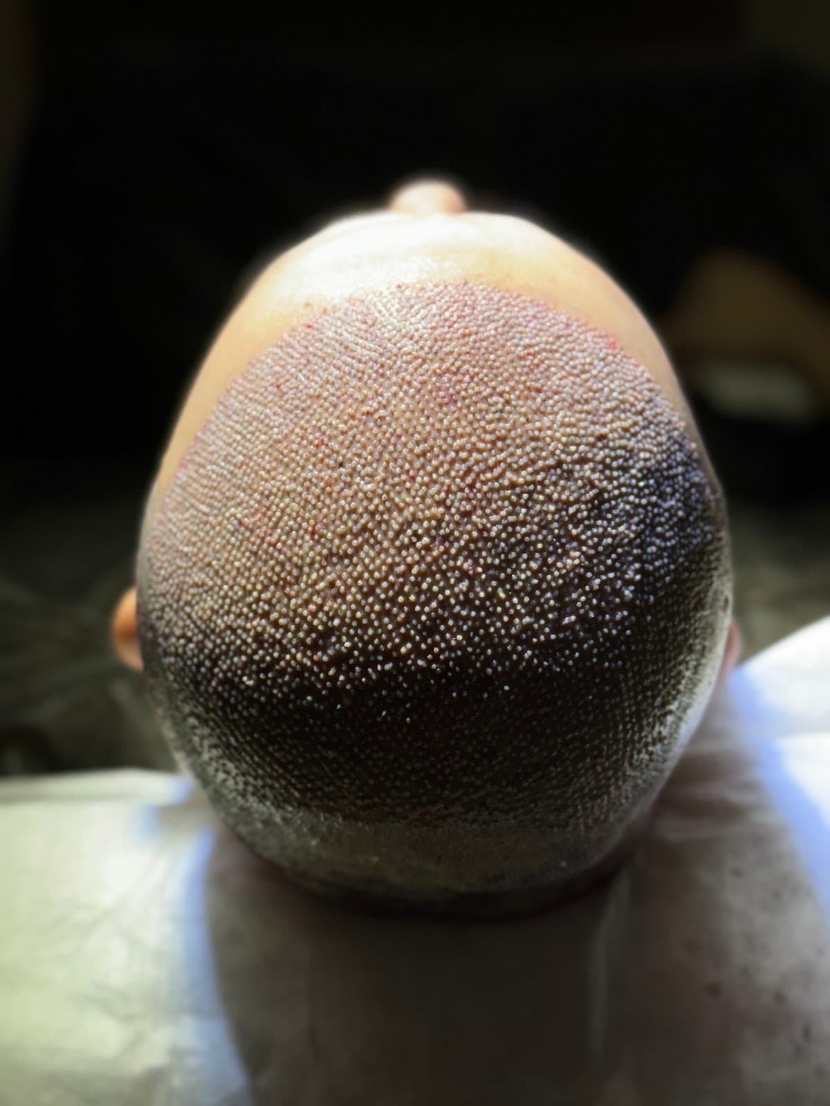 Turkey Luxury Clinics