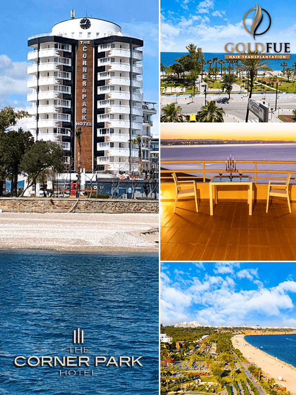 Gold Fue Hair Transplant