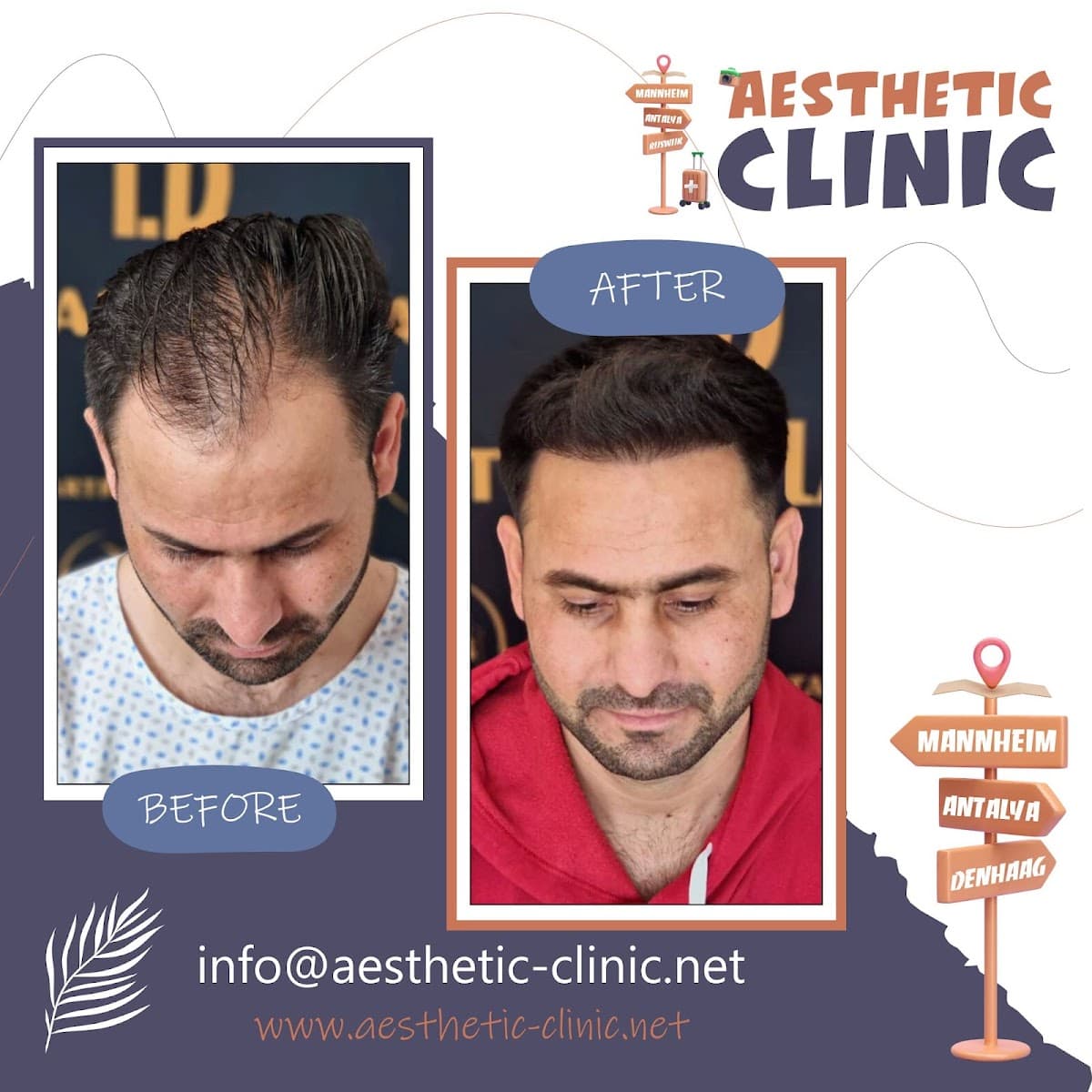 Aesthetic Clinic Antalya
