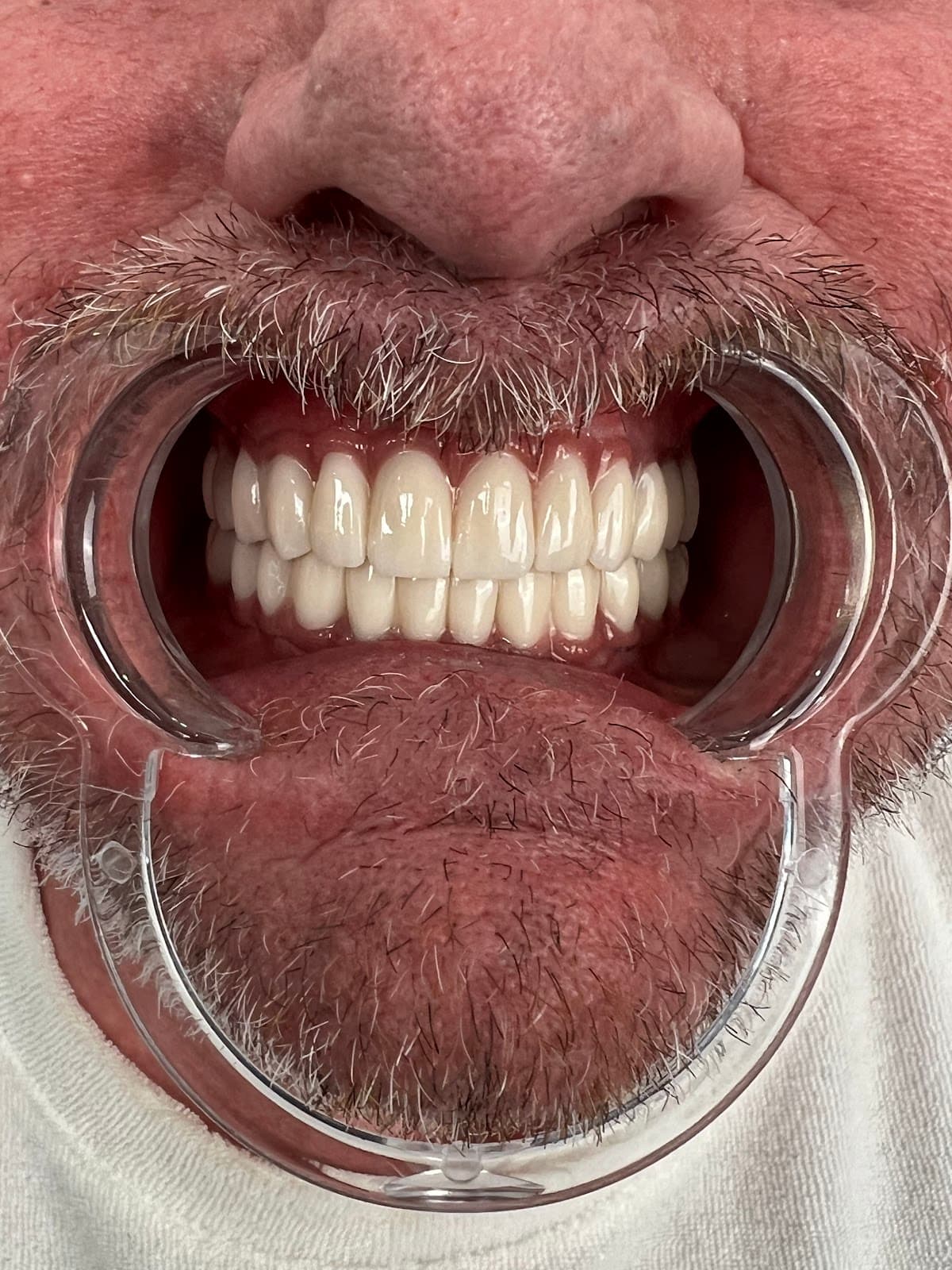 Elysium Dental Turkey