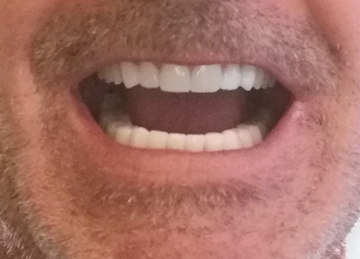 Dentfix Dental Clinic in istanbul Turkey