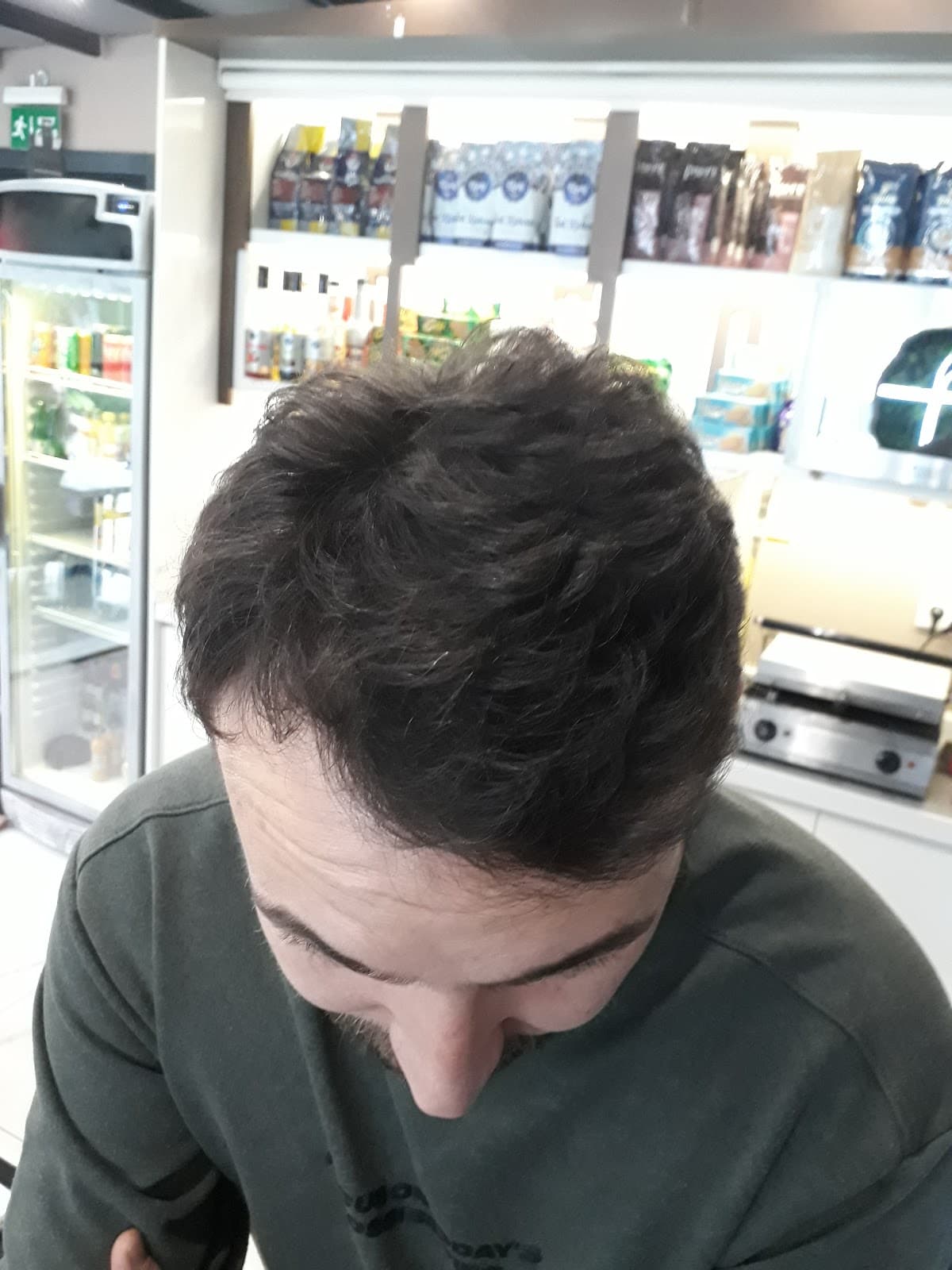 Hair City İstanbul Saç Ekimi