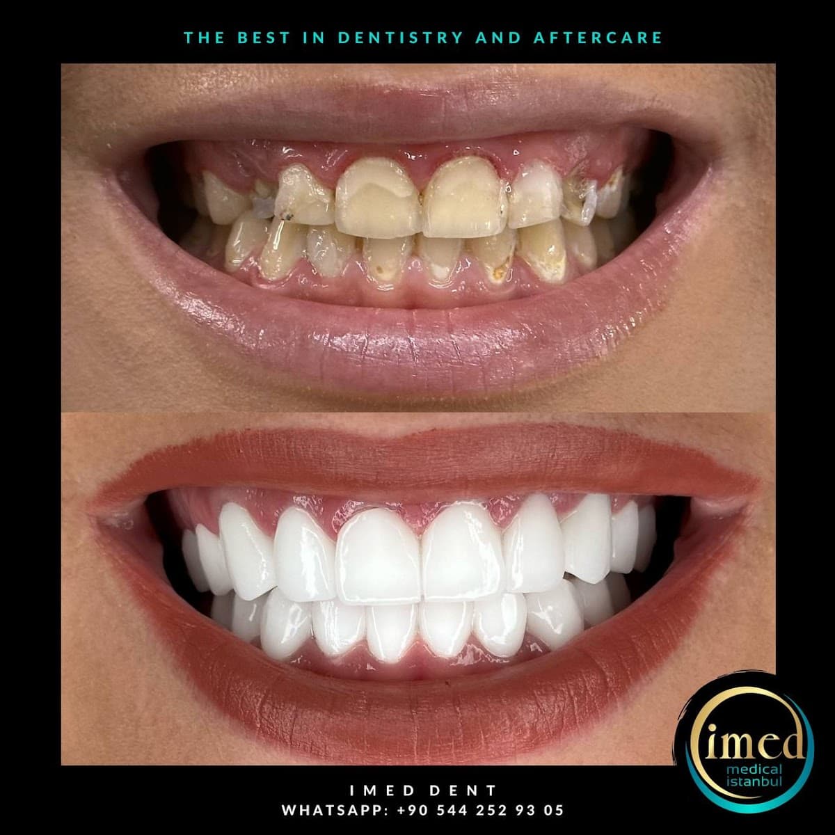 iMed Medical Istanbul