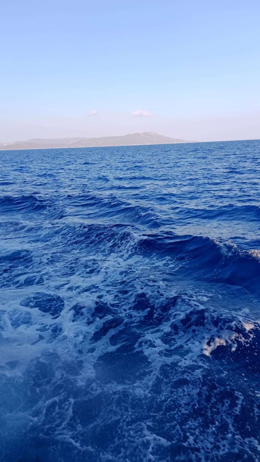 Hair Transplant Antalya