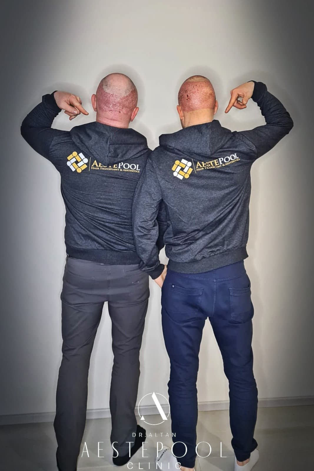 Aestepool Clinic - Dr. Altan Hair transplant Clinic