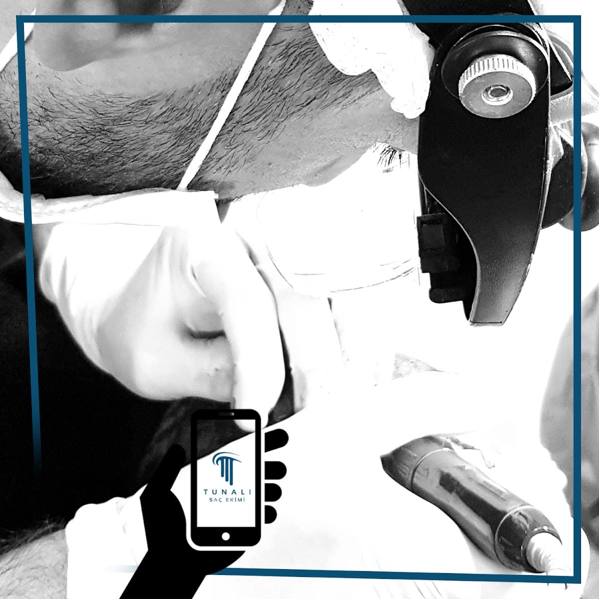 Tunalı Saç Ekimi I Ankara Saç ekimi