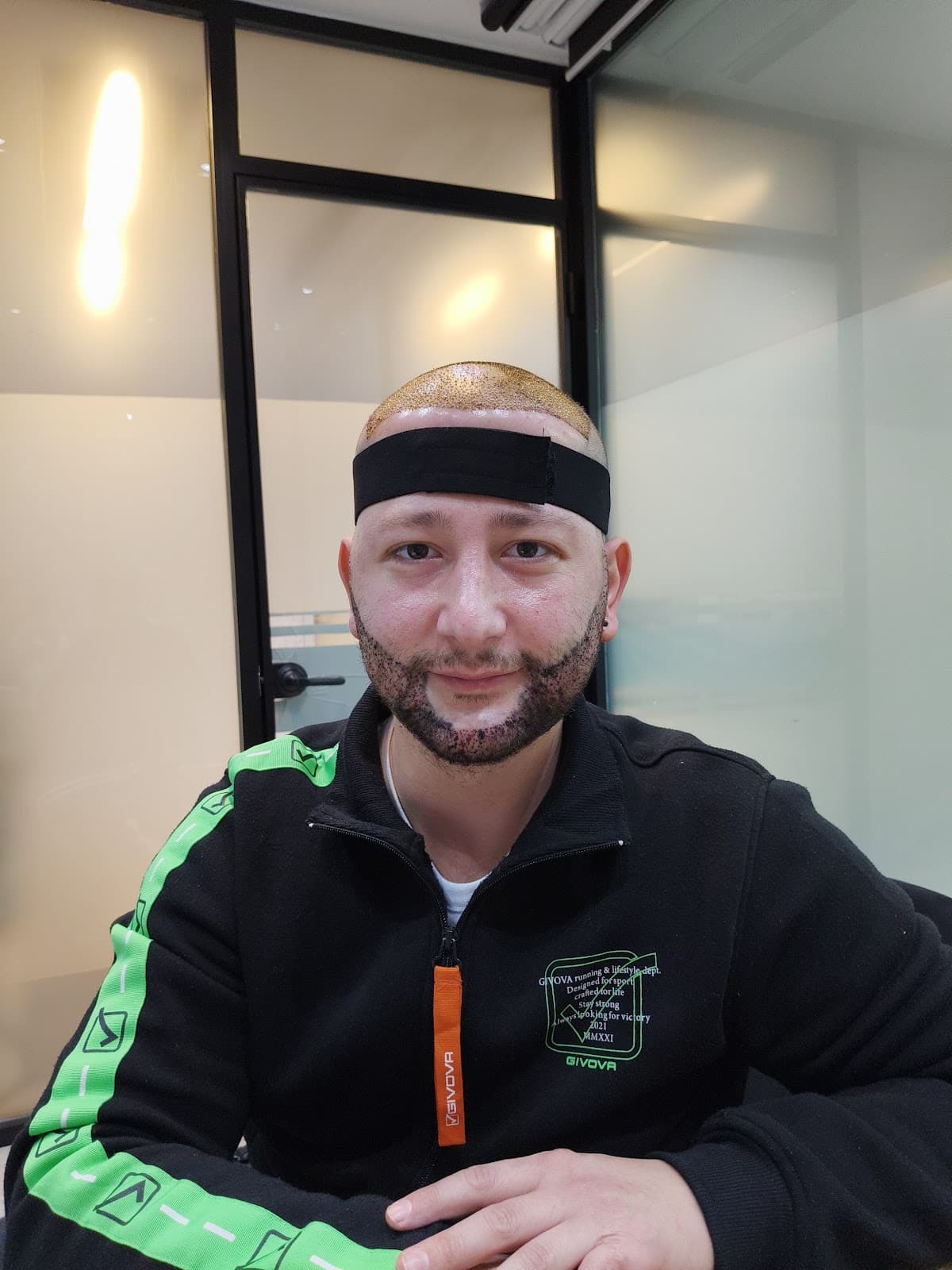 Royal Hair Istanbul | Hair Transplant Turkey