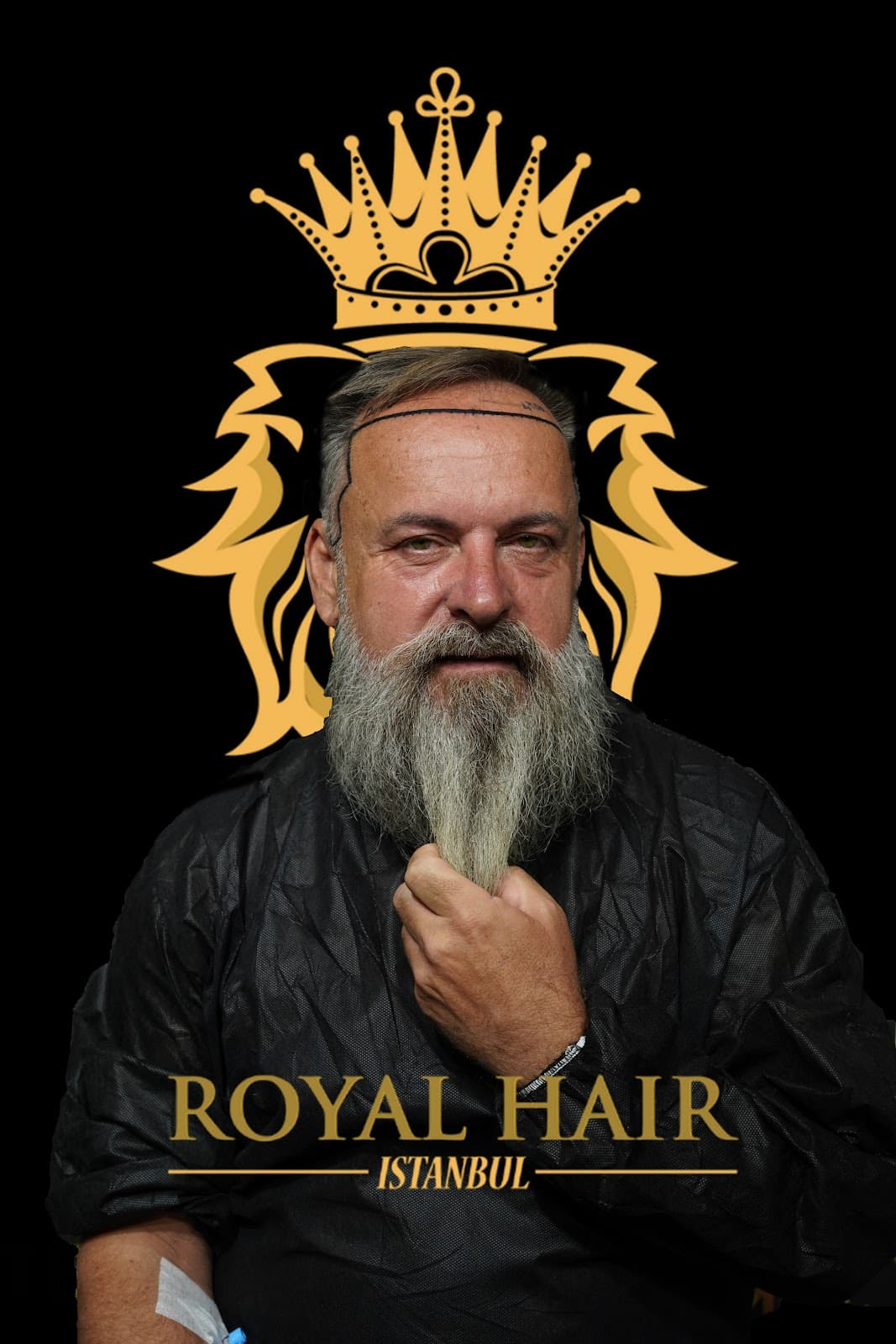 Royal Hair Istanbul | Hair Transplant Turkey