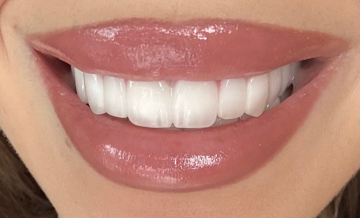 Dental Ezel | Premium Dental Clinic Istanbul