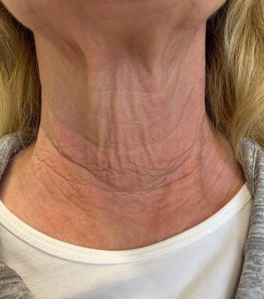 Vivid Clinic | Cosmetic Surgery Istanbul, Turkey