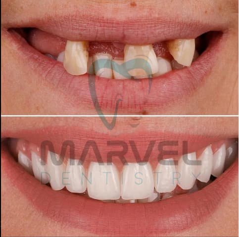 Marvel Dental Clinic