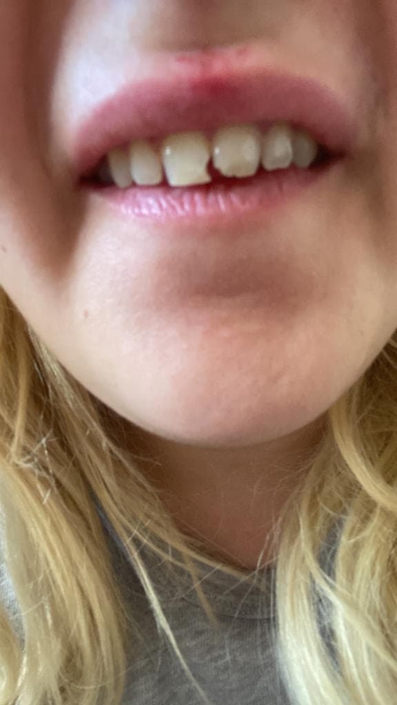 Novedent - Best Dental Clinic in Turkey