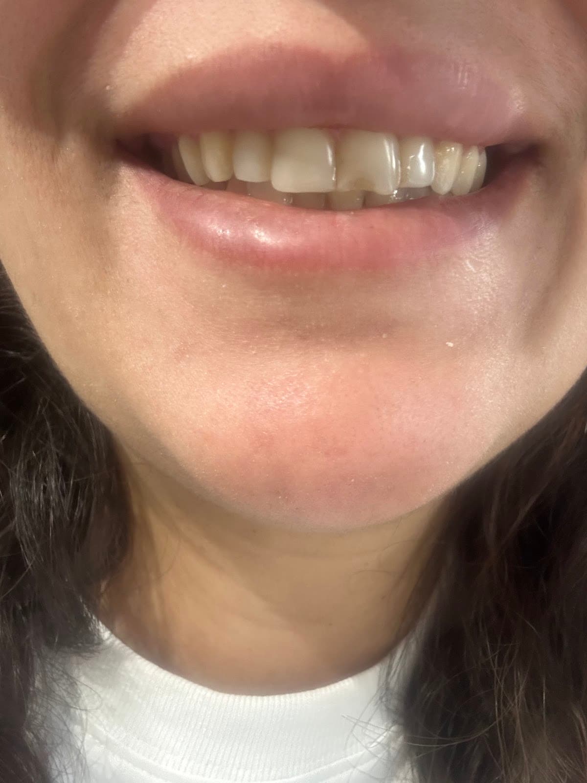 Novedent - Best Dental Clinic in Turkey