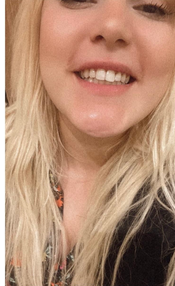 Novedent - Best Dental Clinic in Turkey