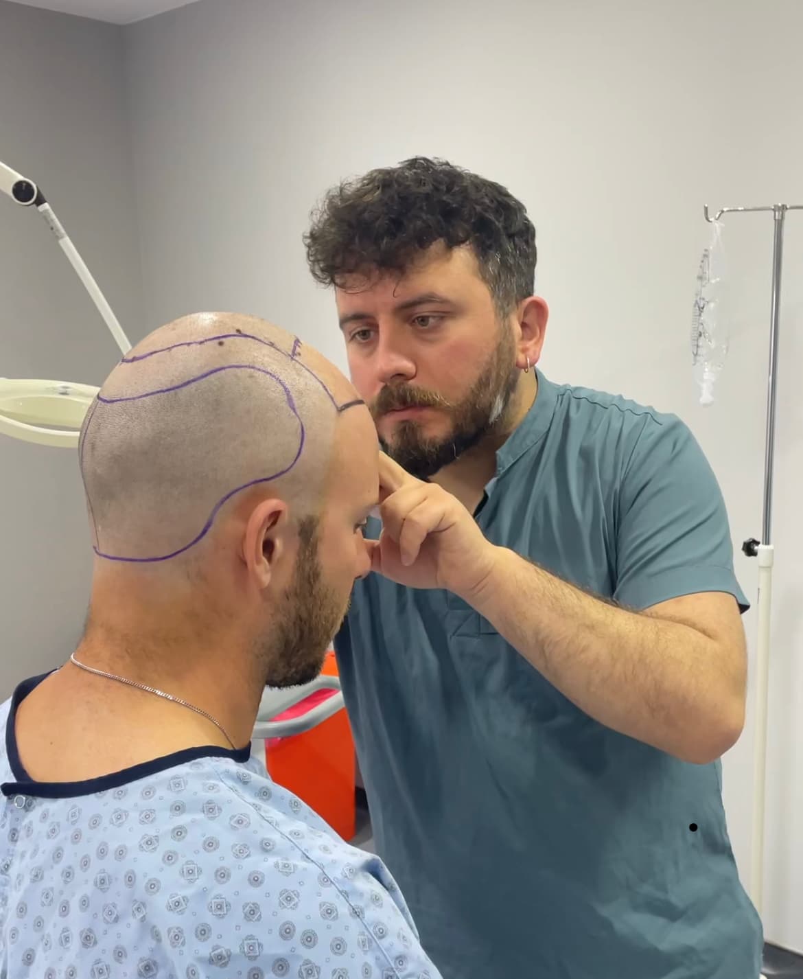 Hair in istanbul | Hair Transplant in Turkey
