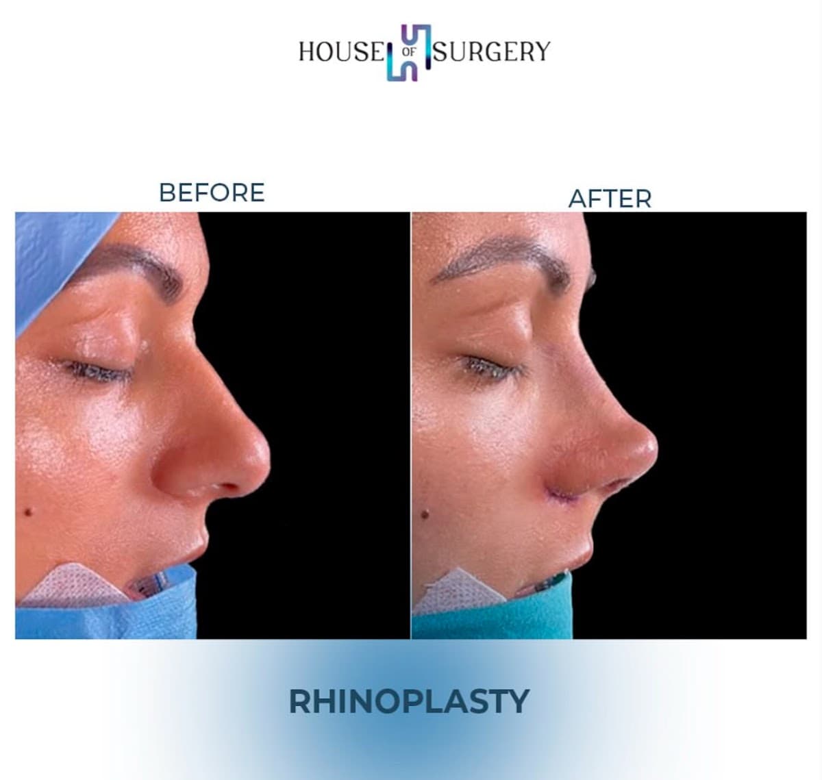 House of Surgery Turkey