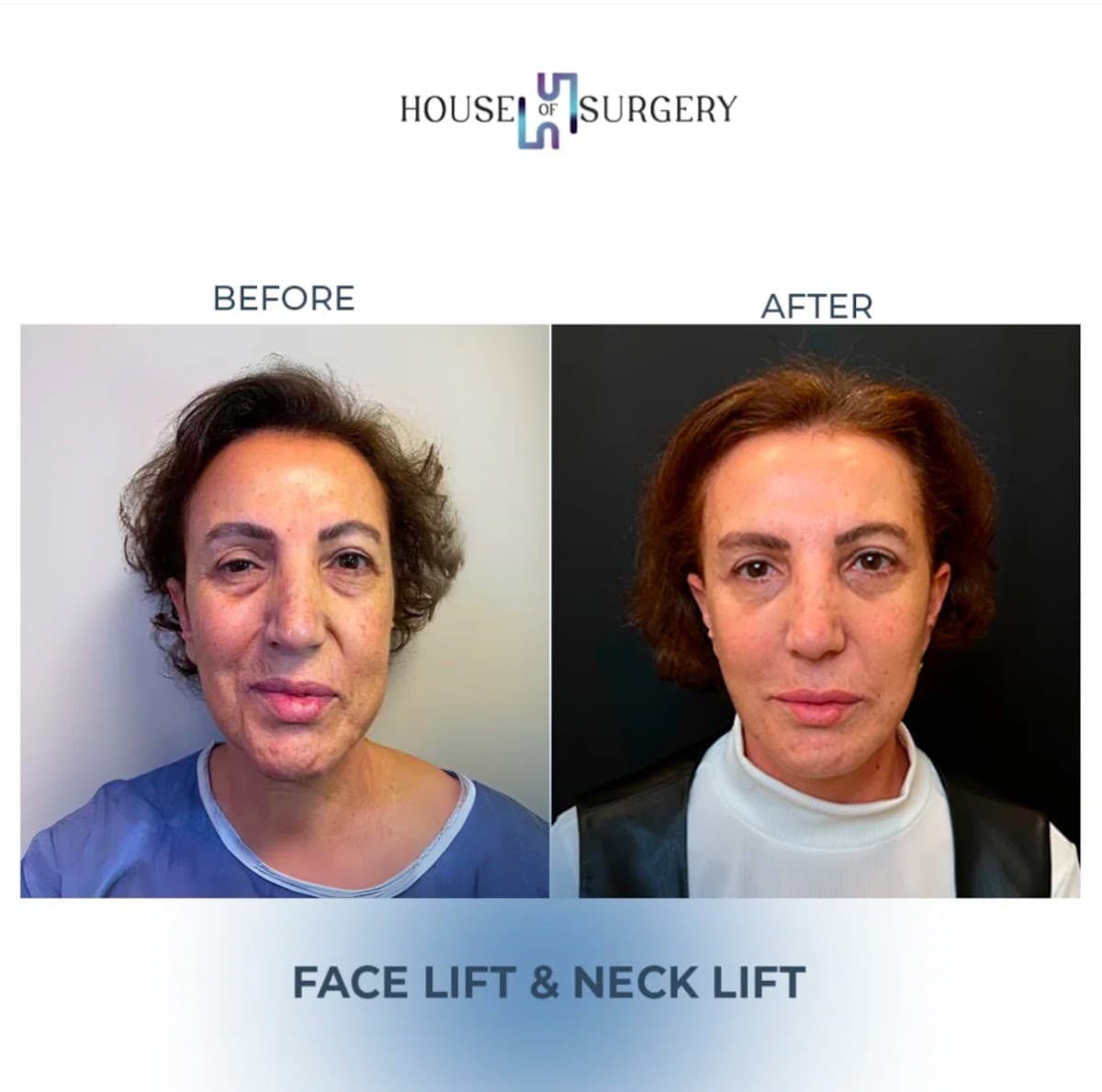 House of Surgery Turkey