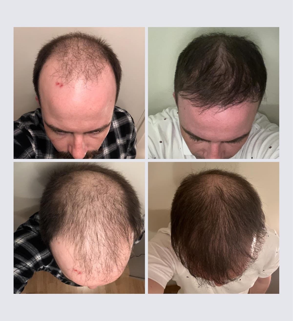 Clinicana Hair Transplant & Esthetic Surgeries