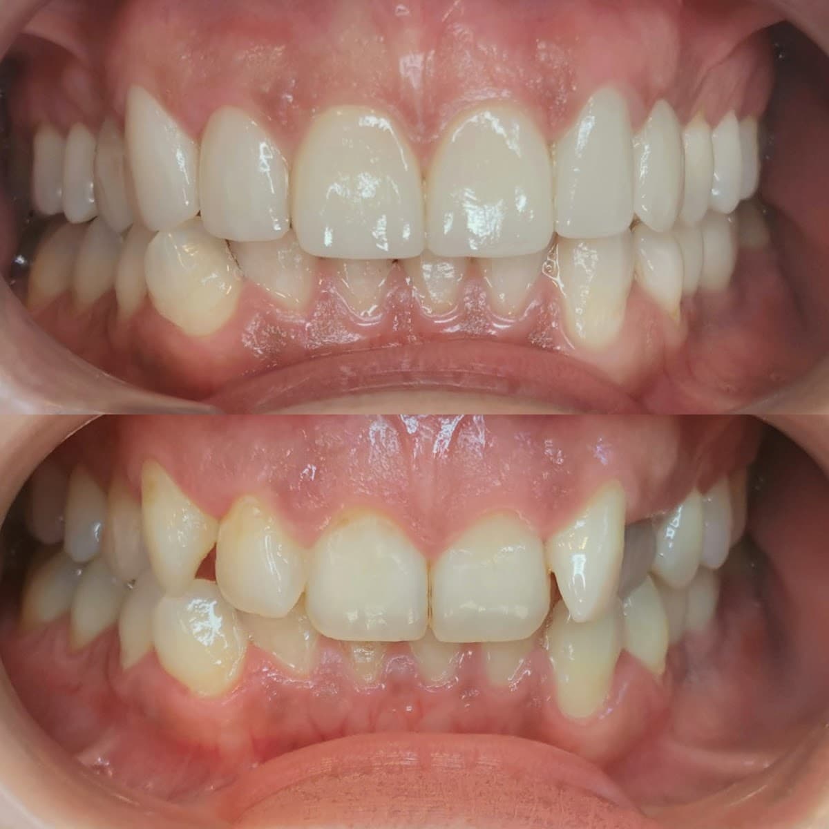 Diş Hekimi Pınar Kutay - Şişli İmplant - Zirkonyum - Gülü...