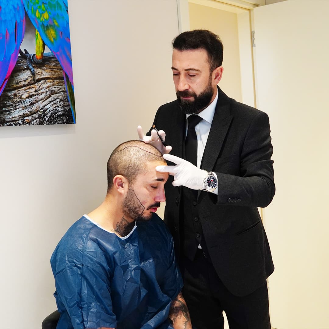 byhairclinic | Hair Transplant Center