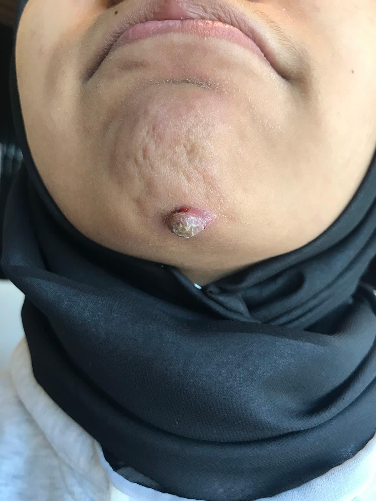 Akdiş Ağız ve Diş Sağlığı Polikliniği