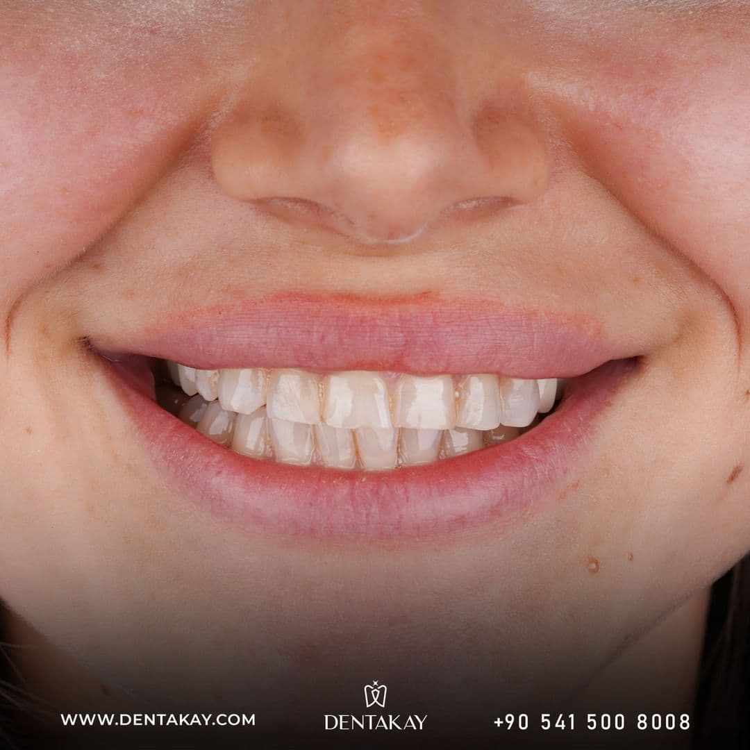 Dentakay Dental Clinic