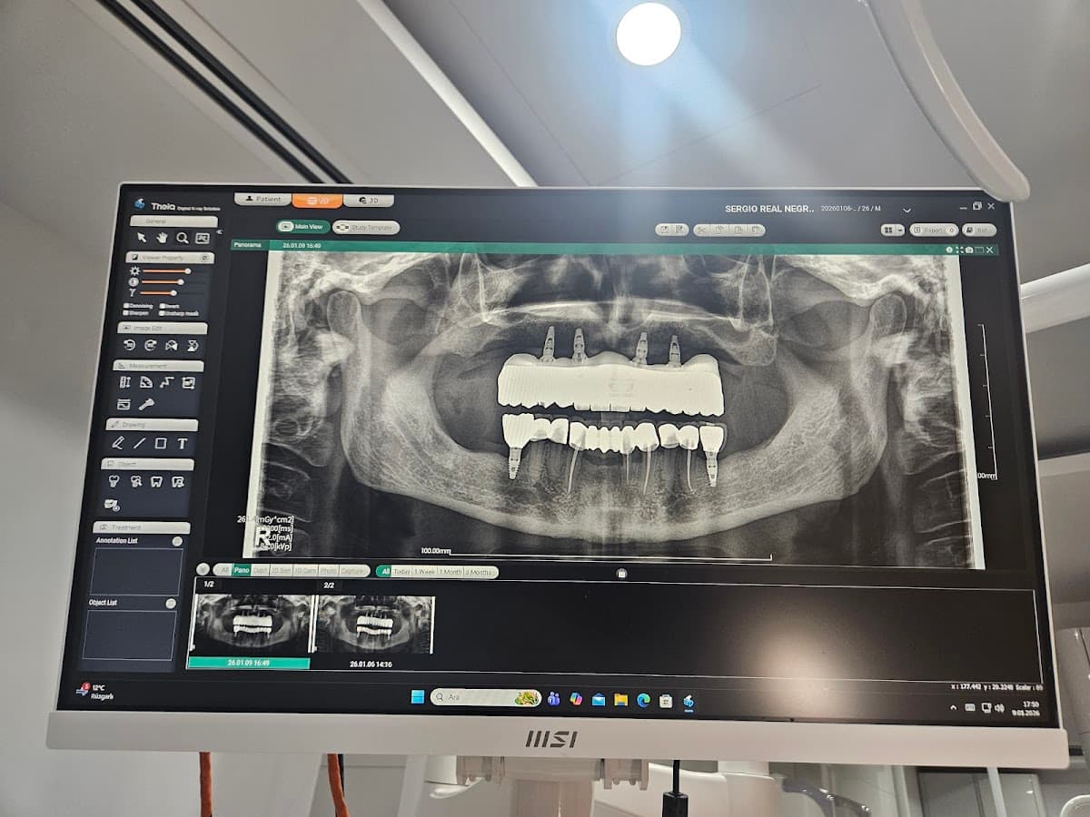 Dentakay Dental Clinic Antalya