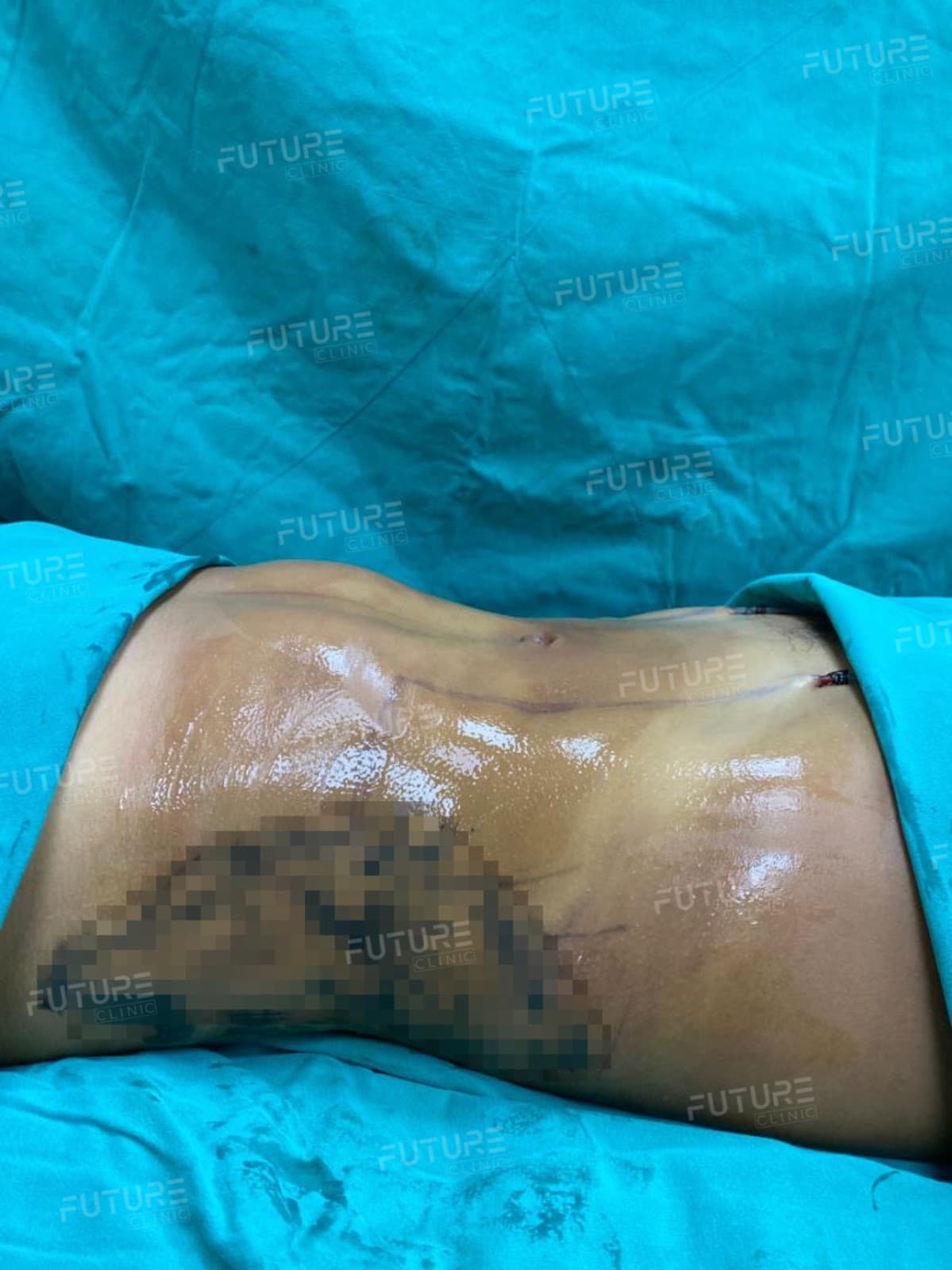 Future Clinic Turkey