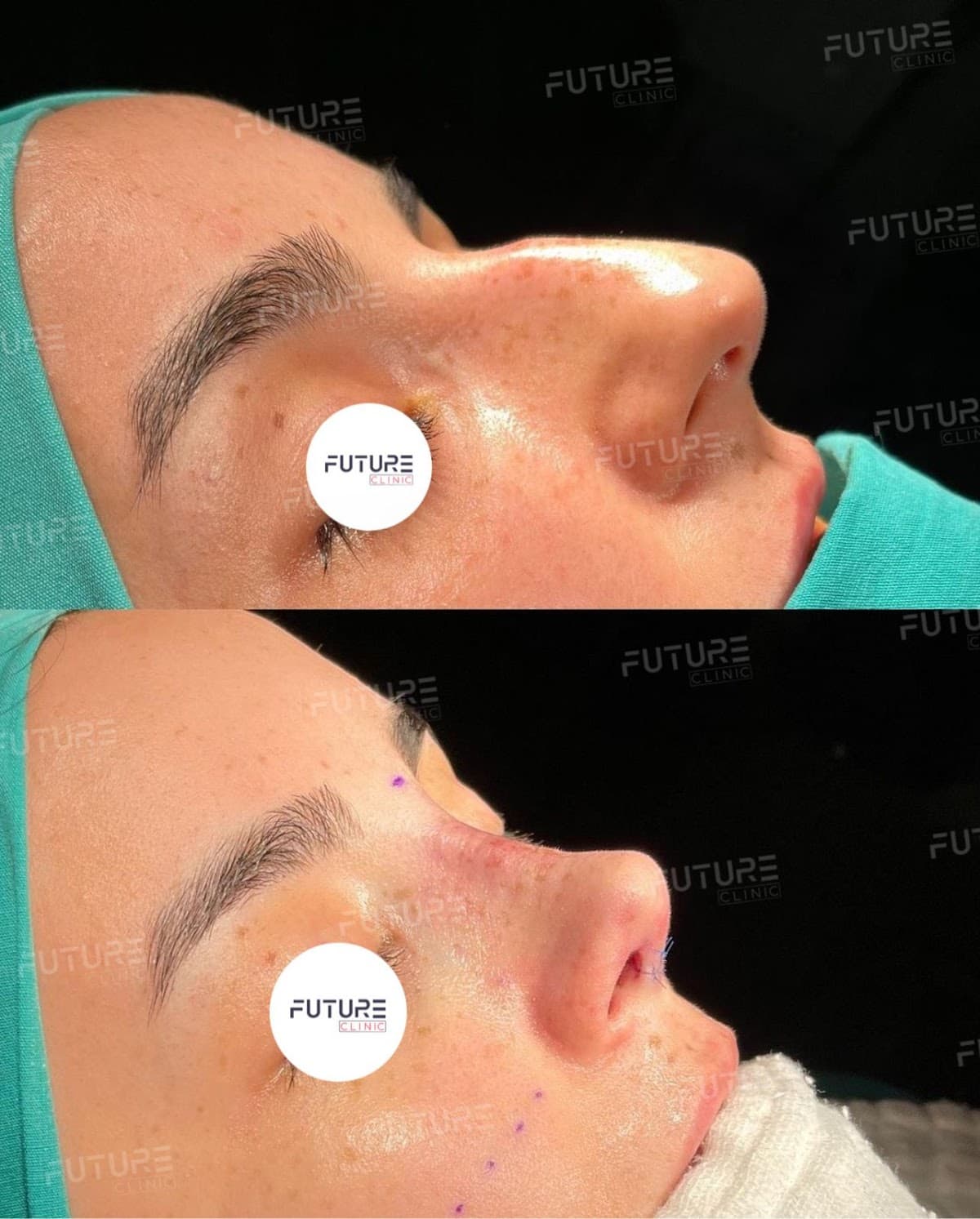 Future Clinic Turkey