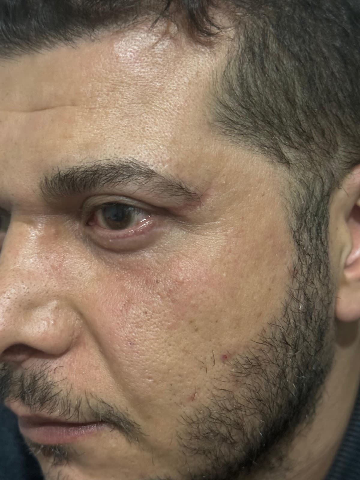 Op. Dr. Gözde Erten - Estetik Plastik Cerrahi Uzmanı