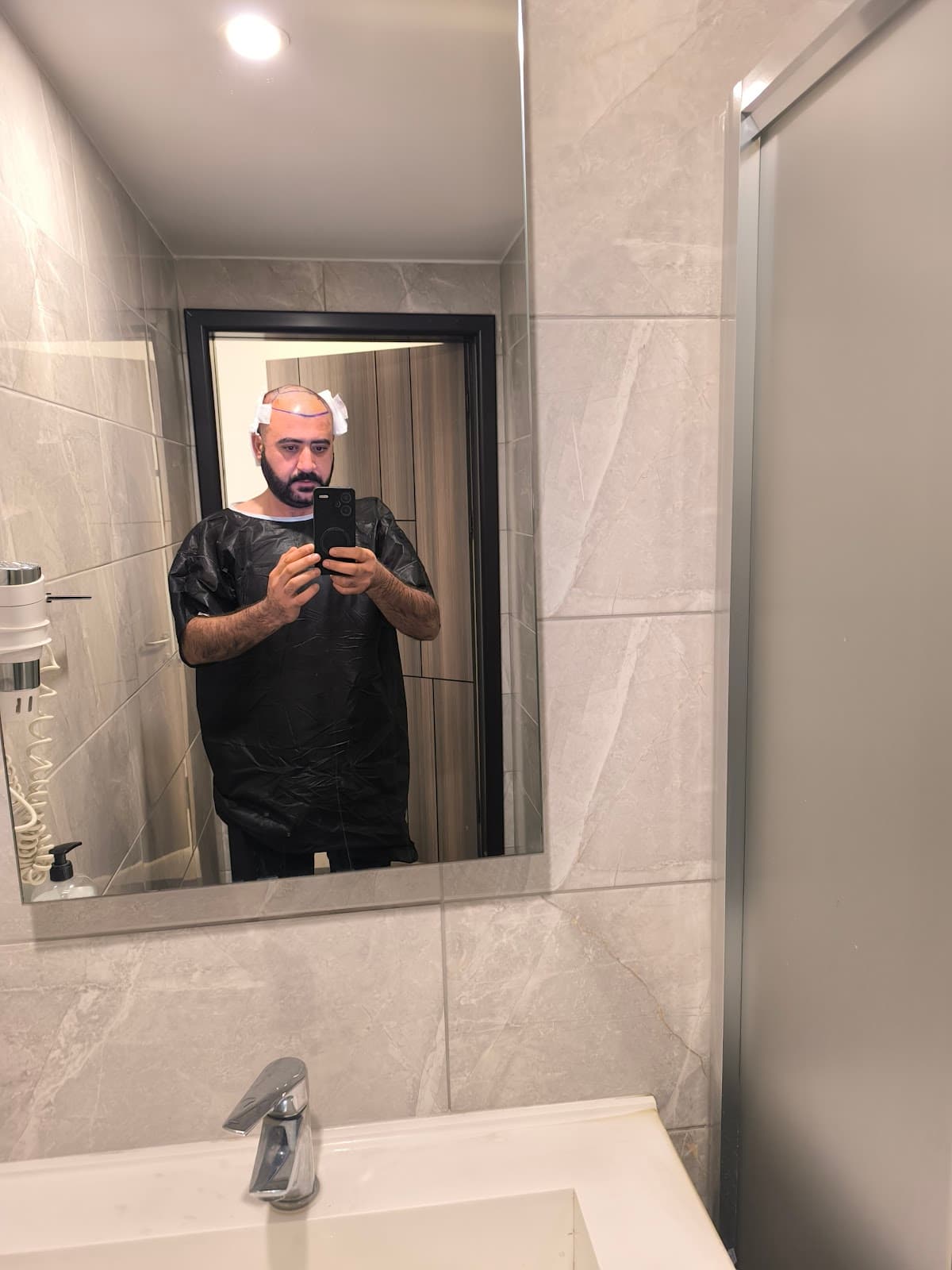 Implant World Hair -BEST HAIR TRANSPLANT CLINIC TURKEY