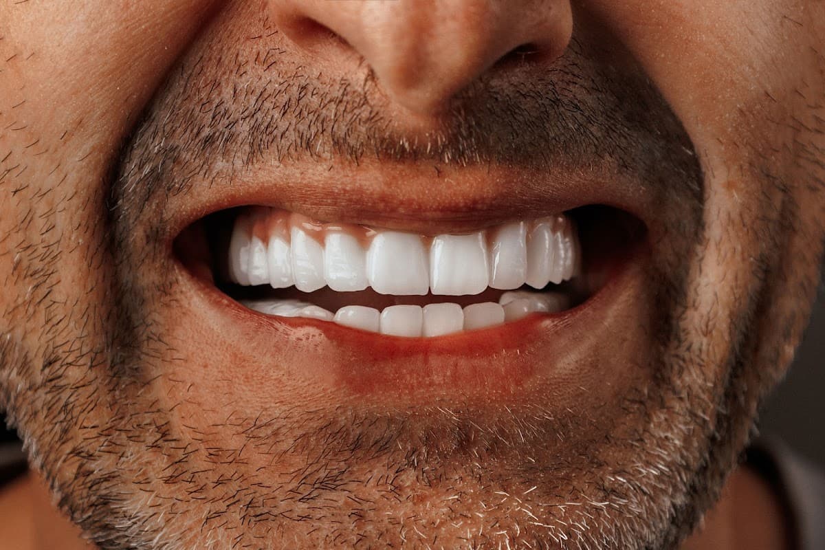 West Dent Clinic Turkey